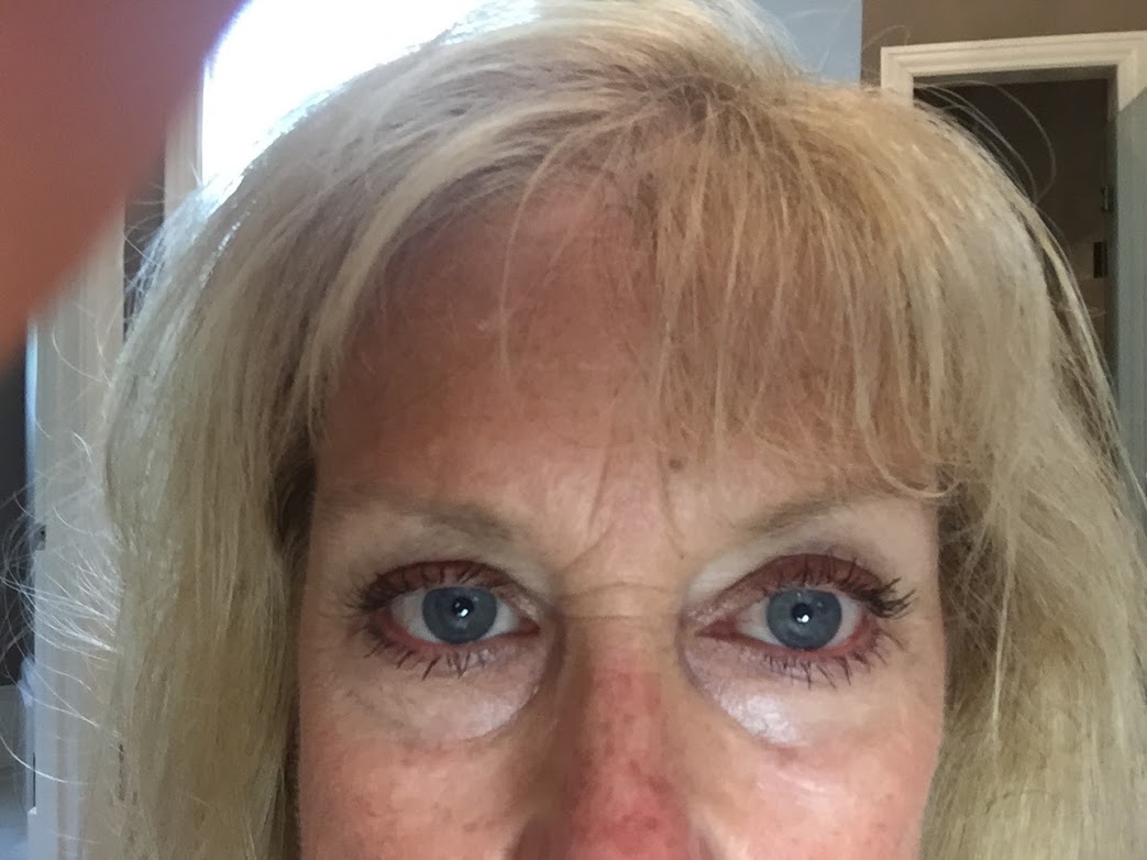 Close look of Robin's eyelashes after using a serum