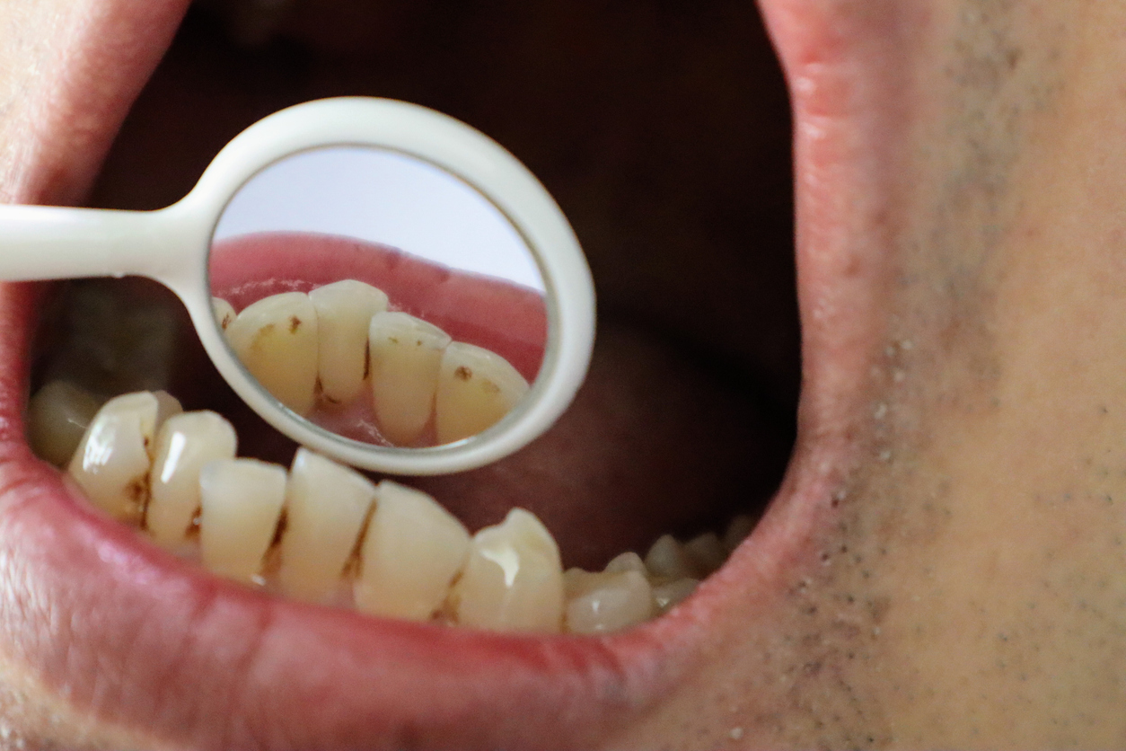 person examining teeth